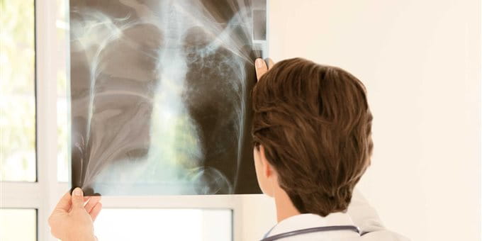 A doctor examines an X-ray image. A doctor examines an X-ray image.